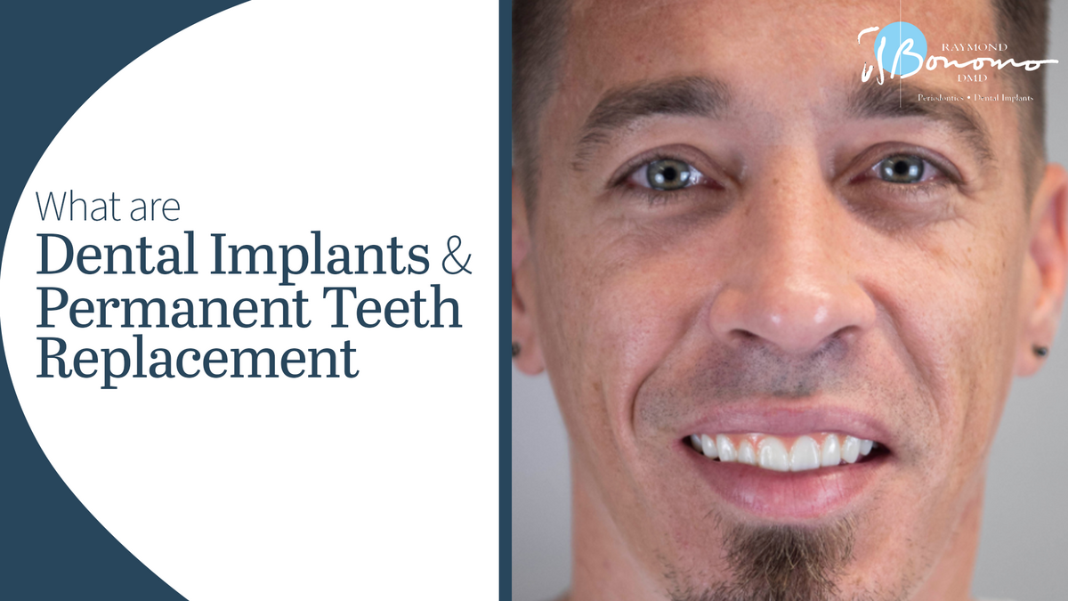A man smiling. The text reads, "What are Dental Implants and Permanent Teeth Replacement?".